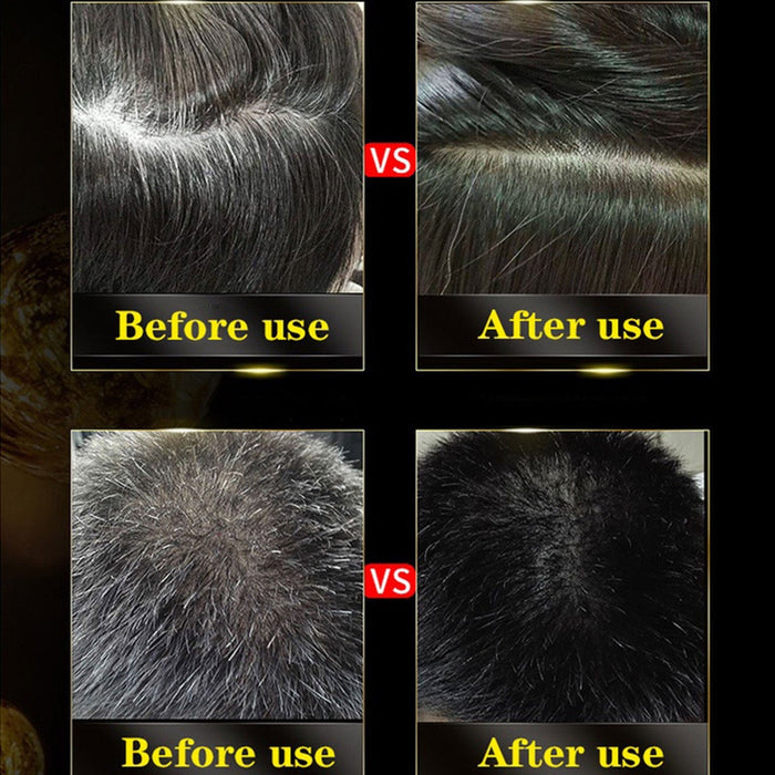 3 in 1 Black Hair Dye Shampoo - Buy 1 Get 1 Free ⏰